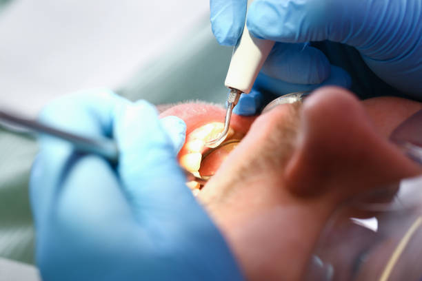 Best Weekend Emergency Dentist in La Cresta, CA